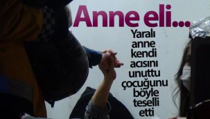 Anne eli... Yaralı anne kendi acısını unuttu çocuğunu böyle teselli etti